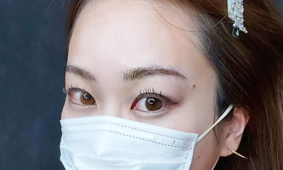 レディアスクリニック-アートメイク-Top