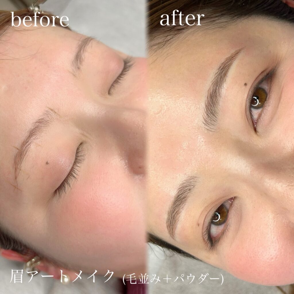 Gメディカルアートクリニック表参道院の体験レビュー！眉アートの実力
