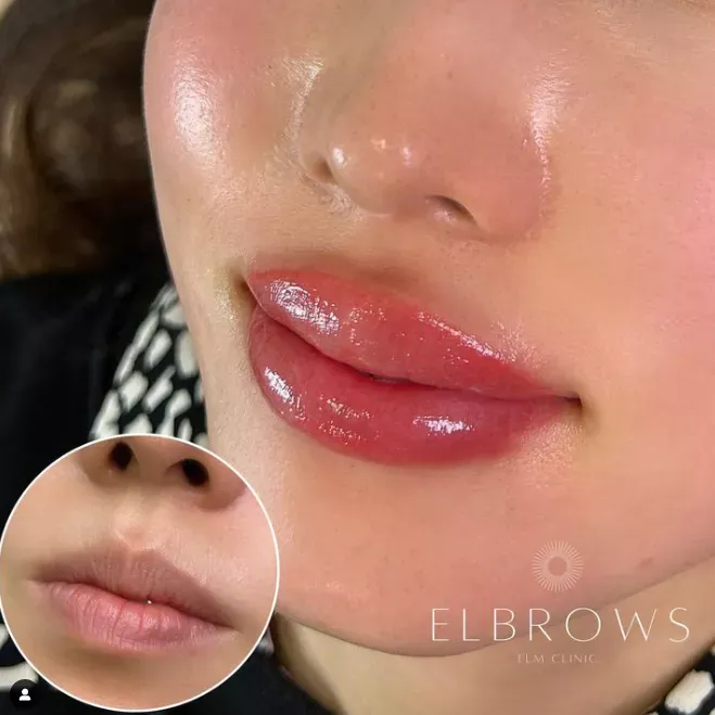 リップ elm-lip-2