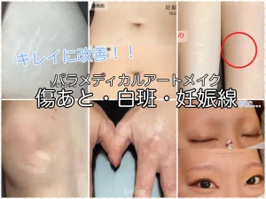 パラメディカルアートメイク