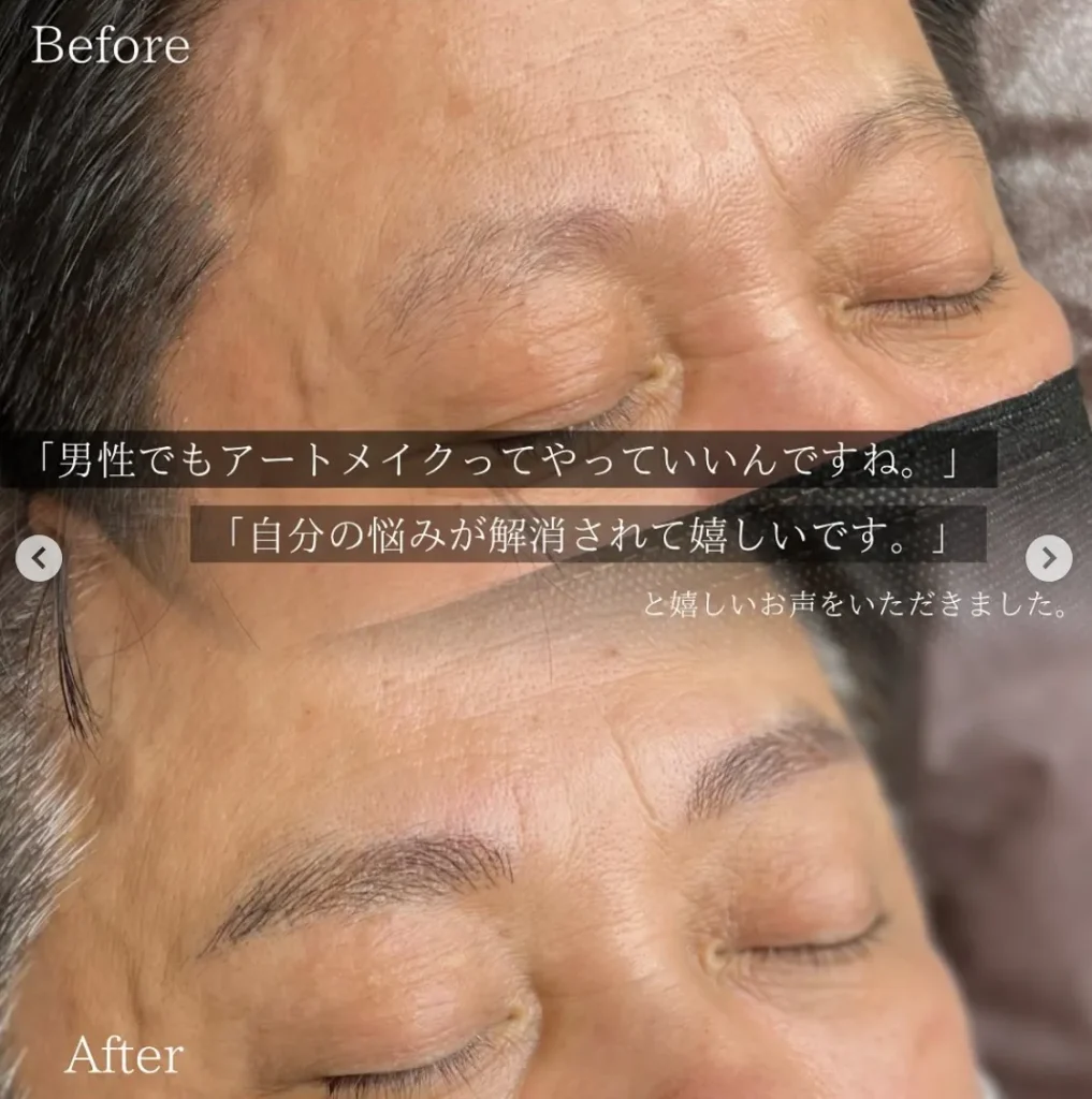ナチュラルアートメイク沖縄症例11