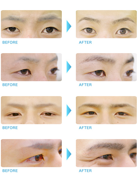 症例　アスー銀座　メンズ