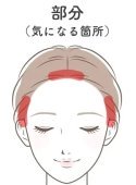 部分