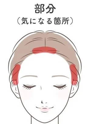 部分